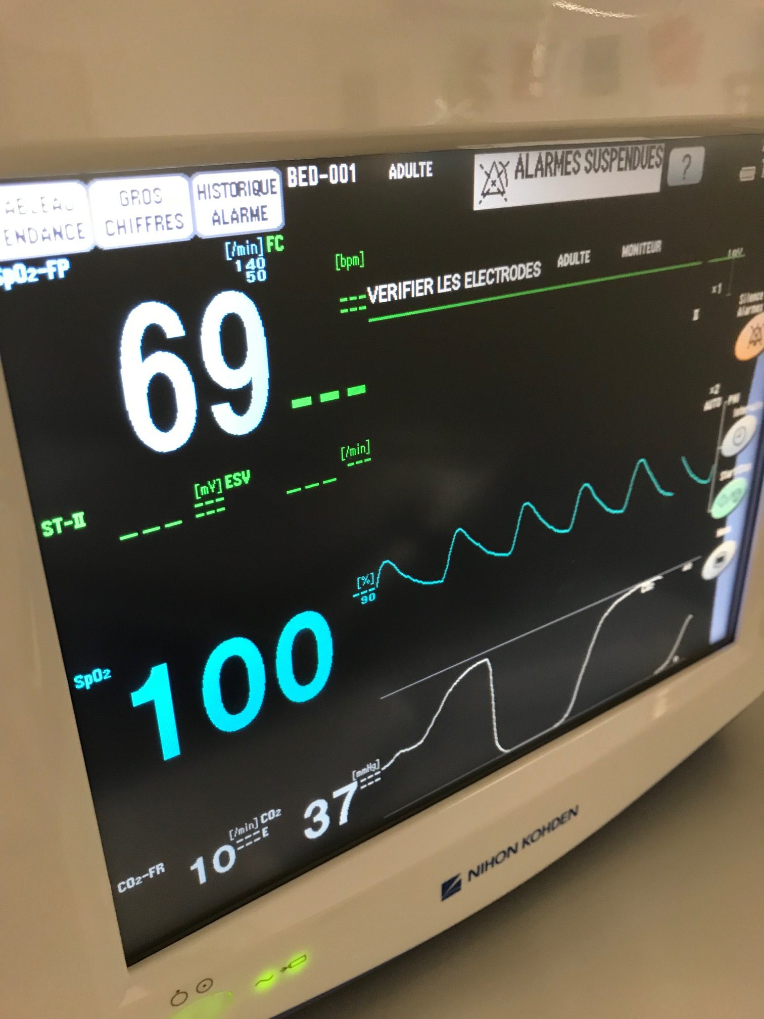 Monitoring anesthésique / chirurgical